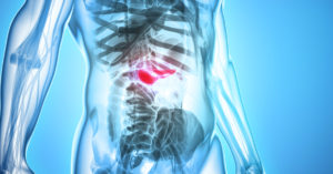 Advanced Chemotherapy Technologies Receives 4 Million NIH Grant to Pursue Pancreatic Cancer Treatment