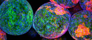 Sigilon Therapeutics Provides Update on Strategic Reprioritization