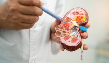 Vera Therapeutics Atacicept Shows Promising Results in Phase 2b ORIGIN Trial for IgA Nephropathy